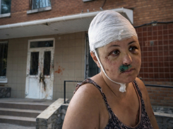 Изнасиловали, разбили череп и бросили: как история из Николаевской области потрясла Херсонщину