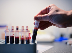 Вспышка ВИЧ-инфекции среди девушек произошла на Херсонщине из-за военных - новый фейк ВСУ