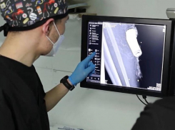 В Херсонской области врачи с сапёрами достали из ноги бойца фрагмент FPV-дрона