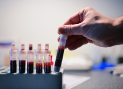 Вспышка ВИЧ-инфекции среди девушек произошла на Херсонщине из-за военных - новый фейк ВСУ