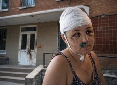 Изнасиловали, разбили череп и бросили: как история из Николаевской области потрясла Херсонщину