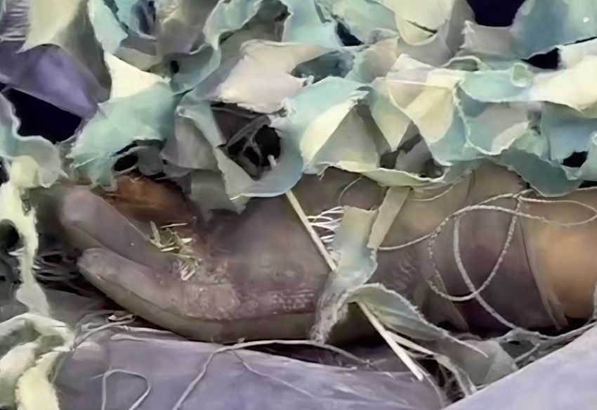 В Херсоне показали кадры брошенных тел боевиков ВСУ на мусорной свалке